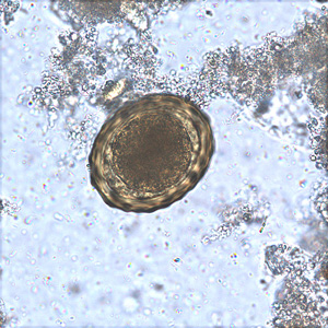 Parasitology Spotlight: Roundworm thumbnail