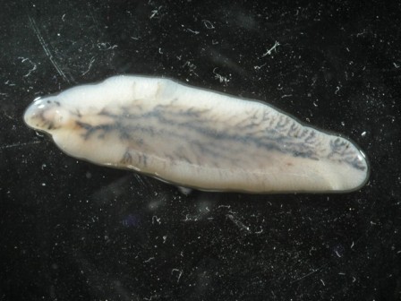 Intestinal Worms thumbnail