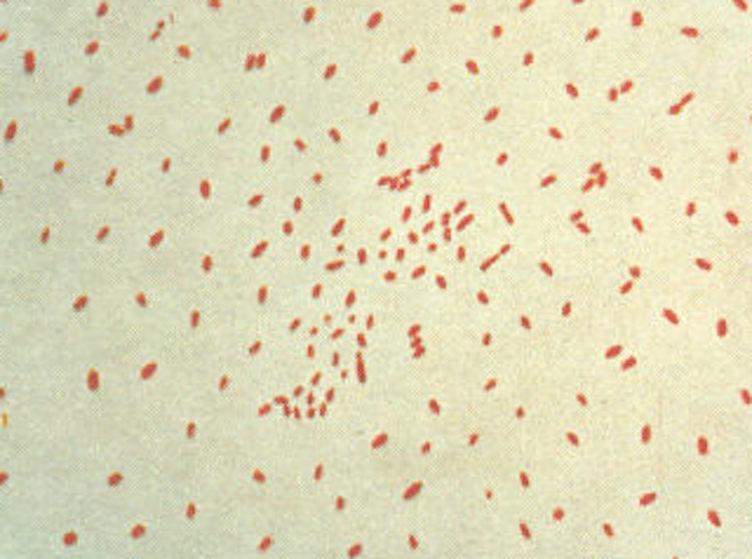 Respiratory Case Study: Possible Pertussis Infection thumbnail