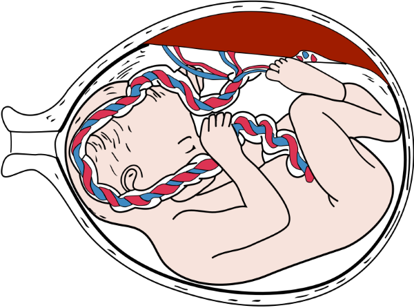Rh-Negative Mother with Anti-D at Delivery: A Case Study thumbnail