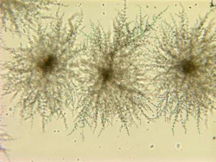 Mycology: Yeasts and Dimorphic Pathogens thumbnail