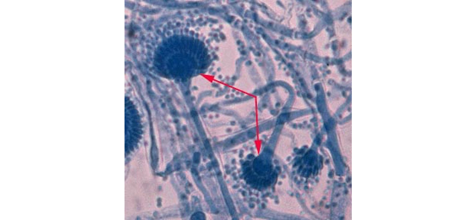 Mycology: Hyaline and Dematiaceous Fungi thumbnail