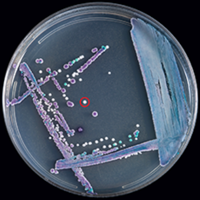 Fungal Threats on the Rise: Candida auris and the Growing Challenge of Invasive Mycoses thumbnail