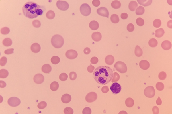 Red Blood Cell Indices thumbnail