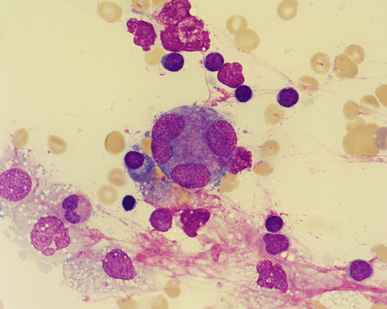 Osteoporosis and the Clinical Laboratory thumbnail