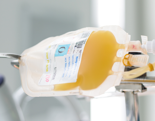 Adverse Effects of Fresh Frozen Plasma Transfusion: TRALI, TACO, and Allergic Reactions thumbnail