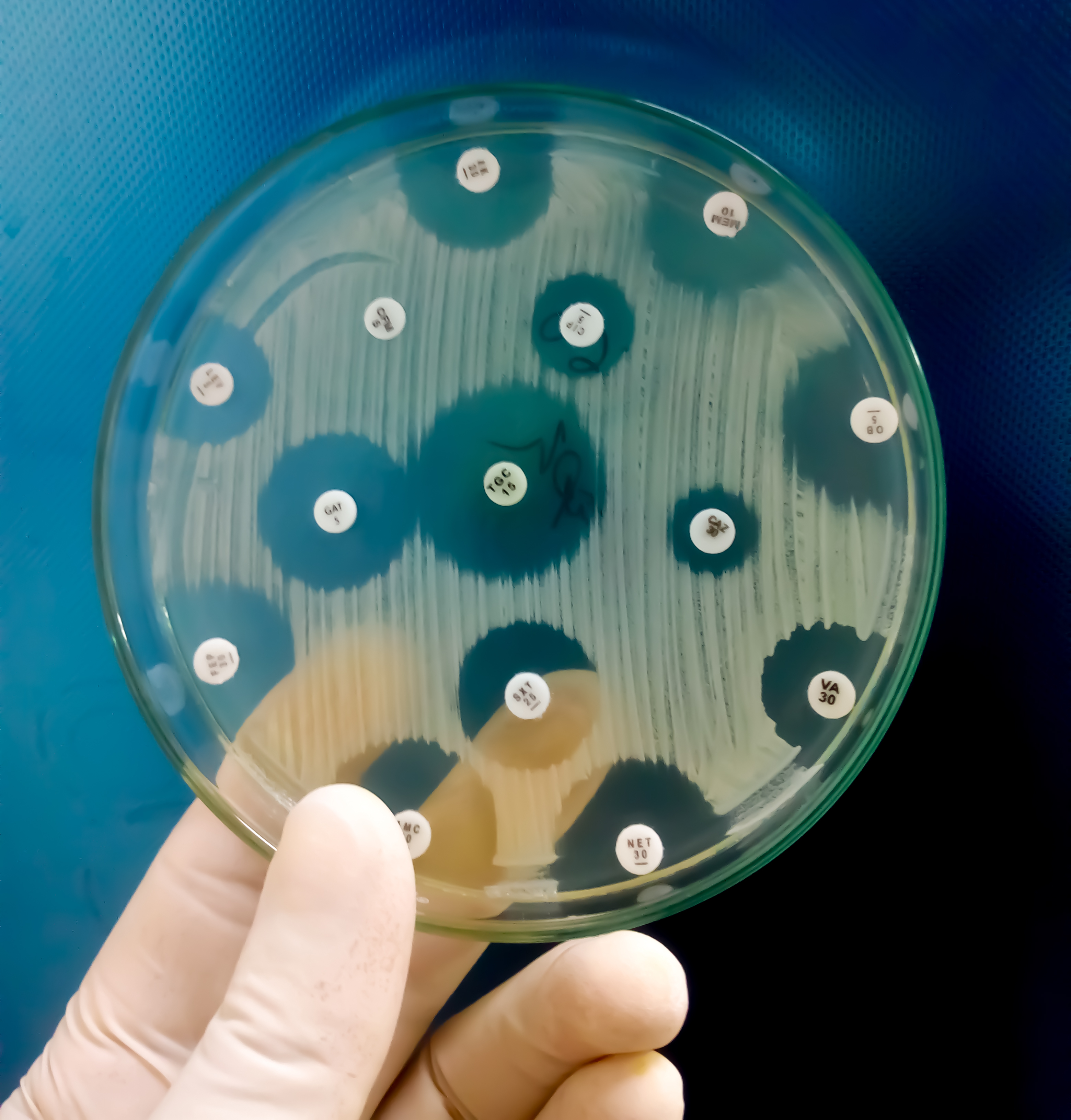 Antimicrobial Action and Resistance thumbnail