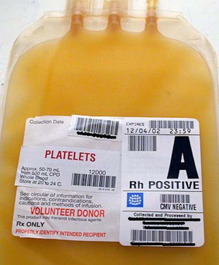 Transfusion Reactions thumbnail