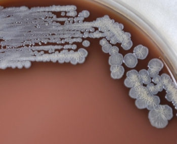 Preliminary Identification of the Primary Select Agents of Bioterrorism thumbnail