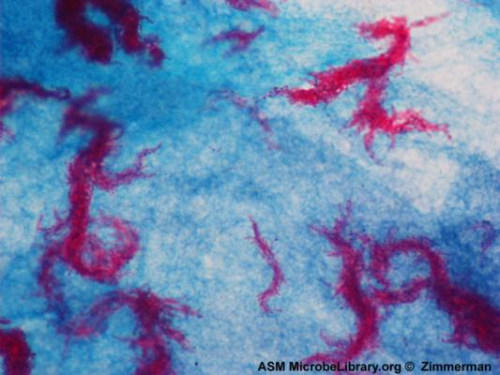Tracking Antibiotic-Resistant Tuberculosis thumbnail