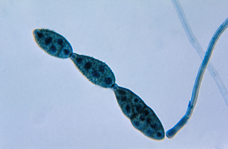 Fungal Infections in Humans thumbnail