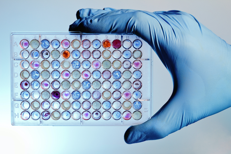 Drug Metabolism thumbnail