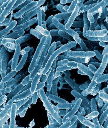 Tuberculosis Awareness for Health Care Workers thumbnail