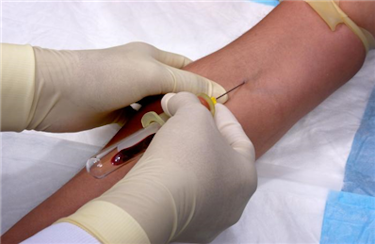 Routine Venipuncture thumbnail