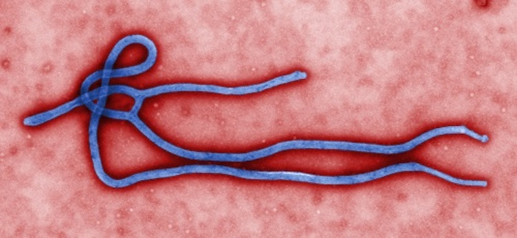 Ebola Virus Disease and Clinical Laboratory Safety in the United States thumbnail