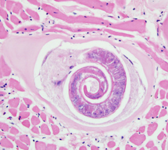 Parasitology Spotlight: Trichinella thumbnail