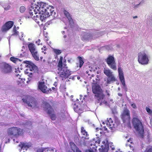 Parasitology Spotlight: Leishmania thumbnail