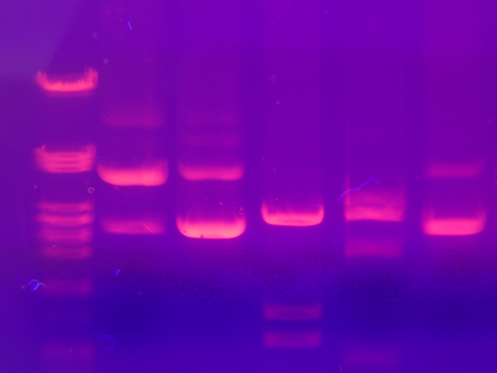 Electrophoresis thumbnail
