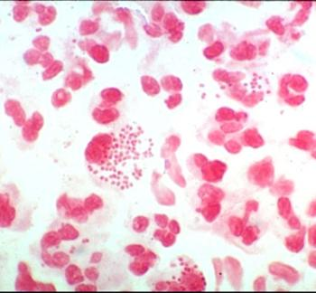 Case Studies in Clinical Microbiology thumbnail