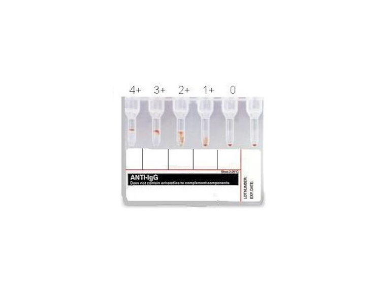 Introduction to the ABO Blood Group System thumbnail