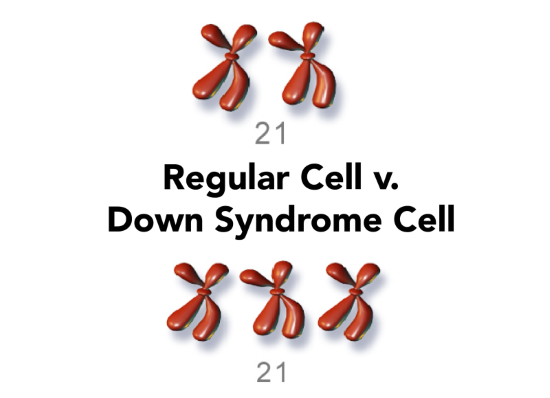 Advances in Noninvasive Prenatal Testing For Down Syndrome and Other Trisomies thumbnail
