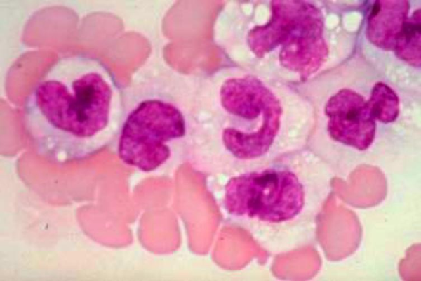 Cerebrospinal Fluid thumbnail