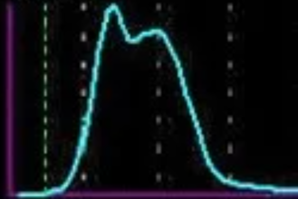 How to Read a Red Blood Cell Histogram thumbnail