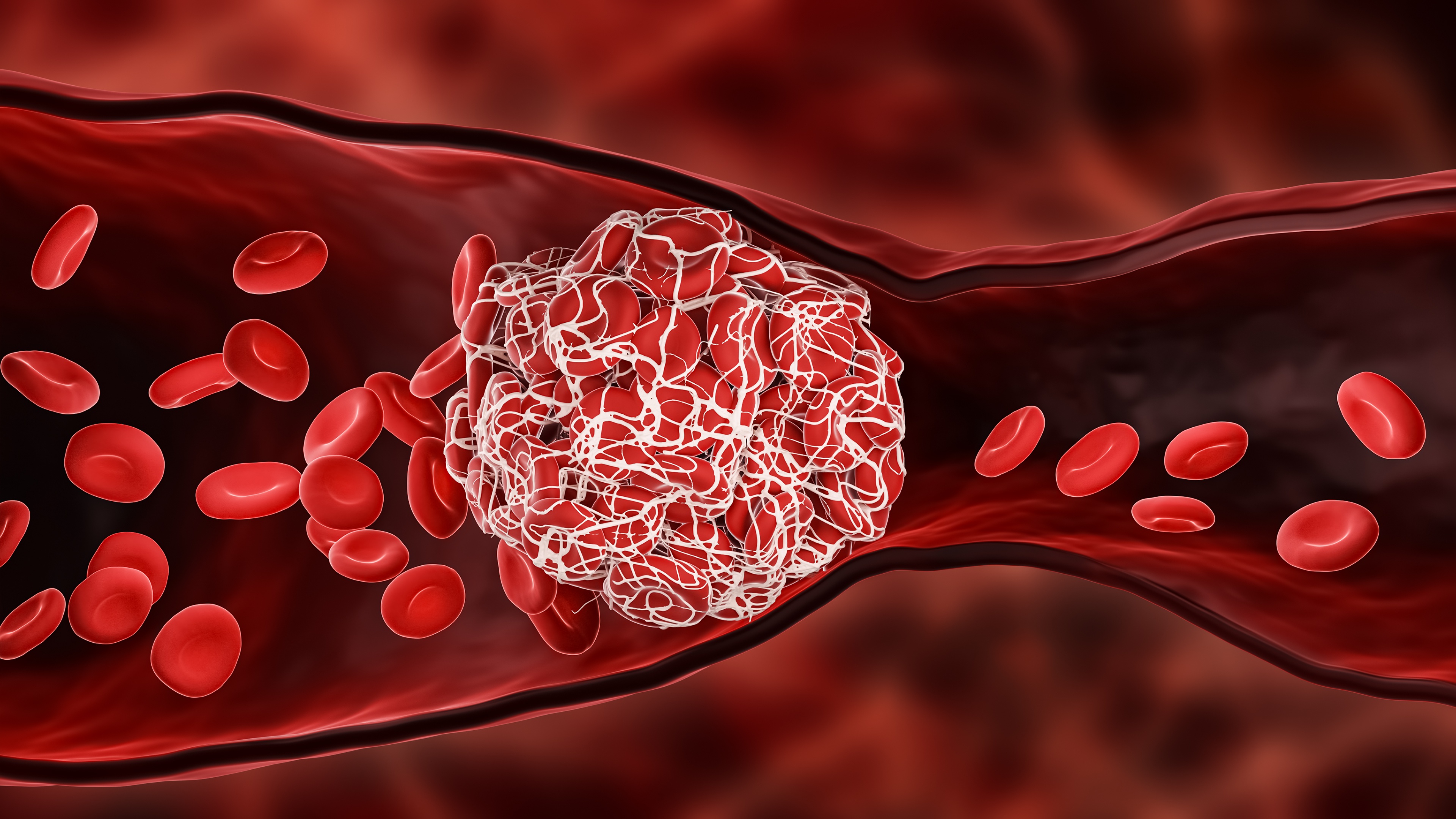 New Oral Anticoagulants thumbnail