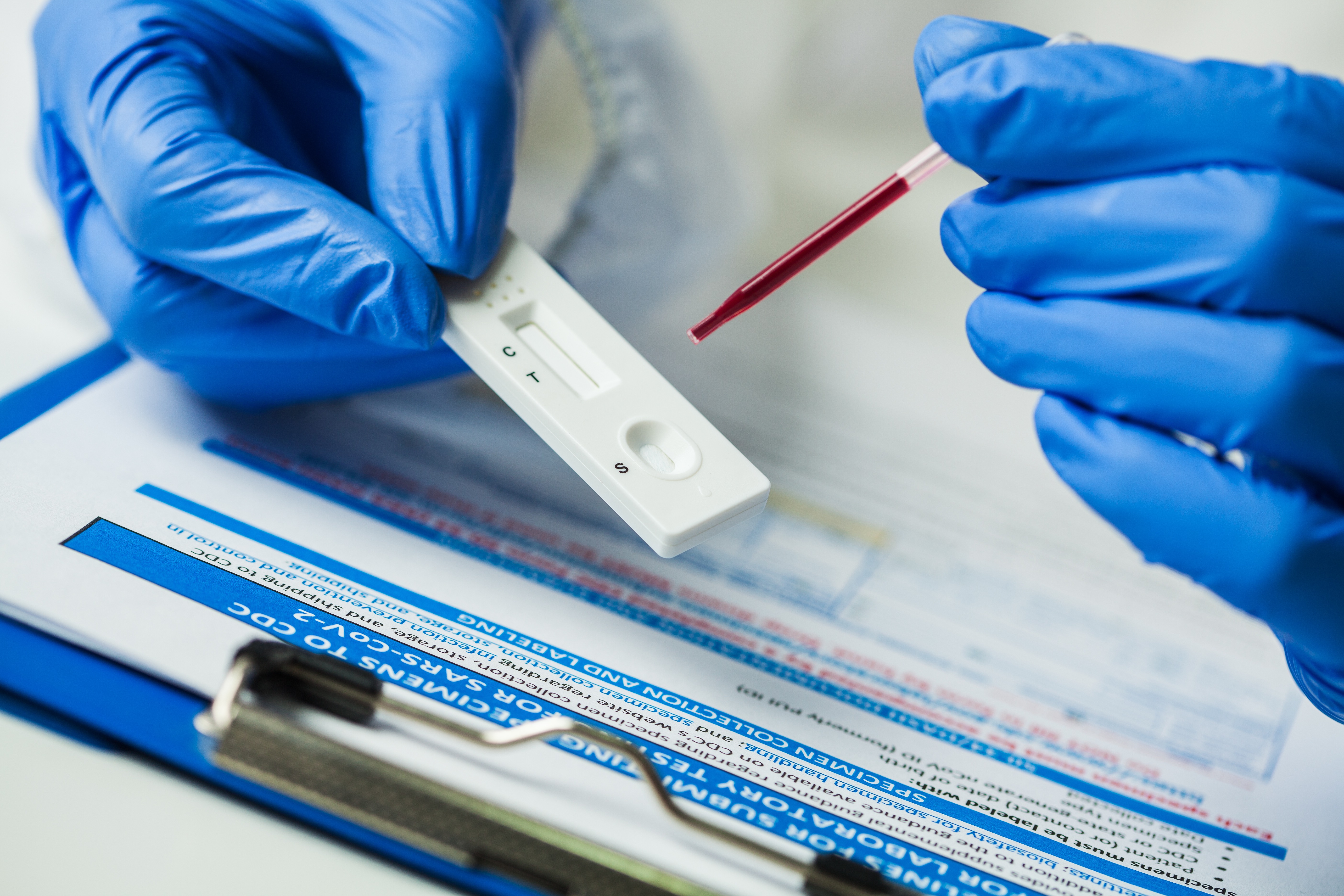 Point-of-Care Testing (POCT): The Applications, Advantages, and Challenges thumbnail