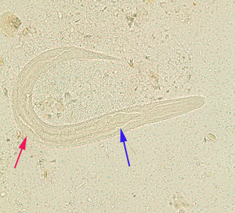 Parasitology Spotlight: Strongyloides thumbnail