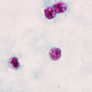 Parasitology Spotlight: Cyclospora thumbnail