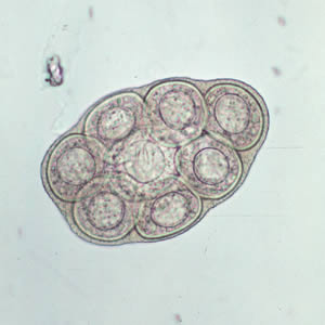 Parasitology Spotlight: Dipylidium caninum thumbnail