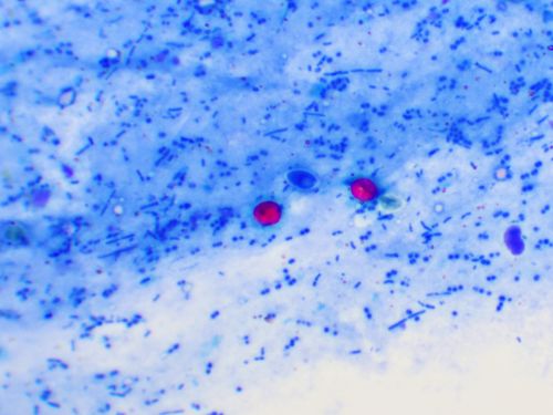 Parasitology Spotlight: Cryptosporidium thumbnail