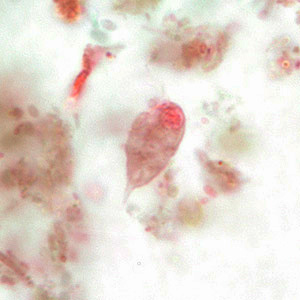 Parasitology Spotlight: Chilomastix thumbnail