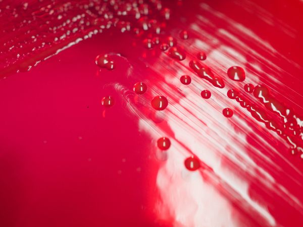 The Resistance Files Spotlight: Drug-Resistant Shigella thumbnail