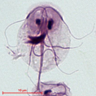 Parasitology Spotlight: Giardia thumbnail