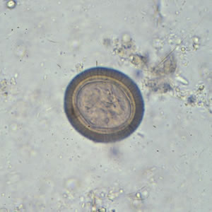 Parasitology Spotlight: Taenia thumbnail