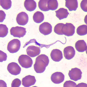 Parasitology Spotlight: Trypanosoma thumbnail