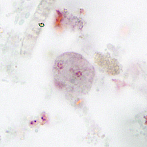 Parasitology Spotlight: Dientamoeba fragilis thumbnail