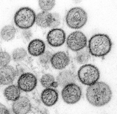 Hantavirus: An Overview of an Emerging Zoonotic Disease thumbnail