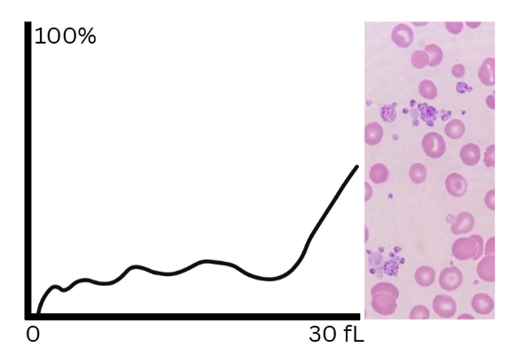 How to Read a Platelet Histogram thumbnail