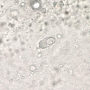 Parasitology Spotlight: Cystoisospora thumbnail