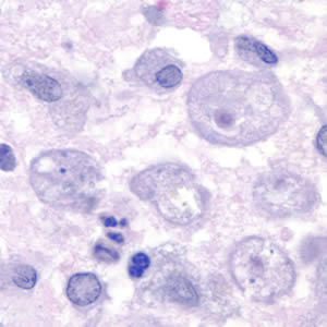 Parasitology Spotlight: Free-Living Amebae thumbnail