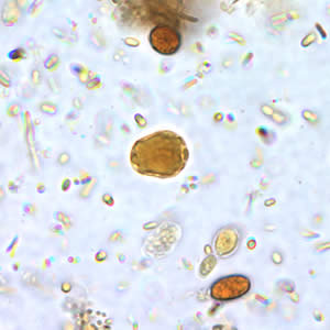 Parasitology Spotlight: Blastocystis thumbnail