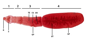 Parasitology Spotlight: Echinococcosis thumbnail