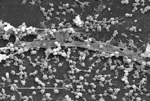 Organism Spotlight: Coagulase-Negative Staphylococci—Contaminant or Pathogen? thumbnail