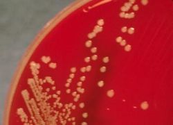 Organism Spotlight: Staphylococcus aureus thumbnail