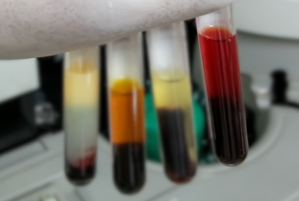 Hematology Interfering Factors: Hemolysis thumbnail