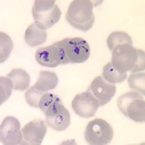 Parasitology Spotlight: Babesia thumbnail