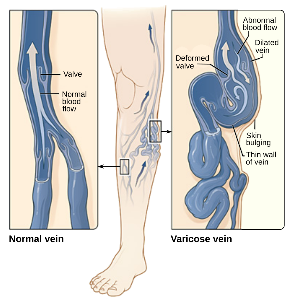 Blog Main Image